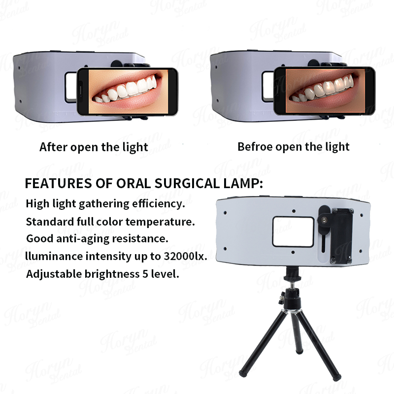 歯科用フラッシュライト,歯科医の写真機器,LED口腔充填ライ - Photography Lighting With Flash のレビューと価格